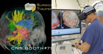 VR医療サービス提供の「Surgical Theater」、新たな提携で脳神経手術の