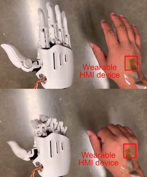 伸縮性のある電子パッチを皮膚に貼ってロボットハンドを制御する技術